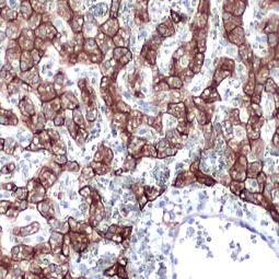 IHC staining of a dog liver section with Cytokeratin 18 antibody – VetSignal™ (GTX134973)