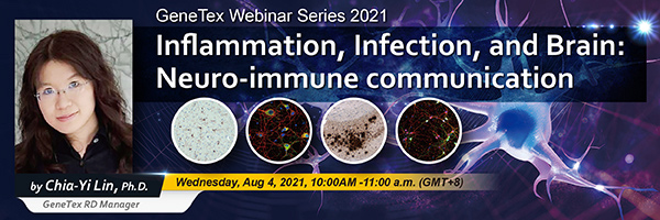 Inflammation, Infection, and Brain: Neuro-immune communication