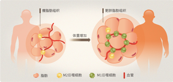肥胖症与糖尿病