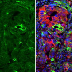 ICAM1 / CD54 antibody [N1C2] (GTX100450)