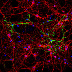 GFAP antibody (GTX108711) 