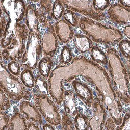 TOMM20 antibody (GTX133756)