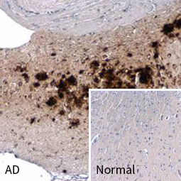 beta Amyloid (1-42) antibody – Conformation Specific (GTX134510)