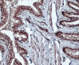 Bmi1 antibody-VetSignal™ (GTX134944)
