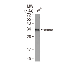 Cyclin D1 antibody-VetSignal™ (GTX134959)

