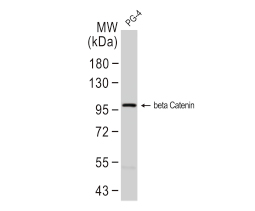 beta Catenin antibody -VetSignal™ (GTX134938)
