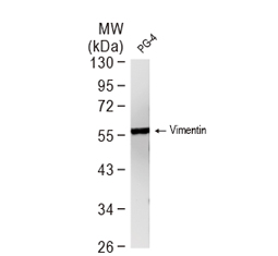 Vimentin antibody [GT7812] - VetSignal™ (GTX635085)

