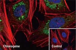 SQSTM1 / P62 antibody [GT1478](GTX629890)