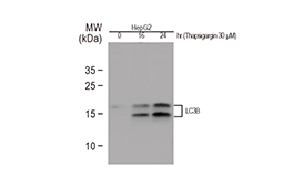 LC3B antibody(GTX127375)