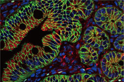 beta Catenin antibody [N1N2-2], N-term(GTX101435)