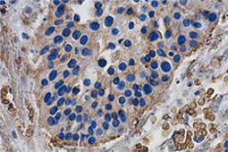 PD1 antibody(GTX128435)