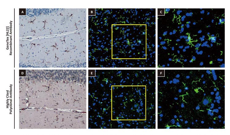 Iba1 antibody [HL22](GTX635363)