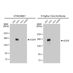EGFR antibody [GT133]