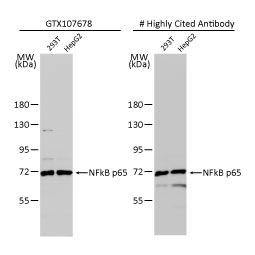 NFkB p65 antibody (GTX107678)
