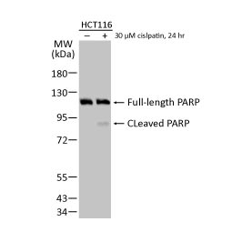 PARP antibody [N2C1], Internal (GTX112864)