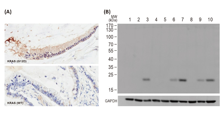 RAS (G12D Mutant) antibody [HL10](GTX635362) 