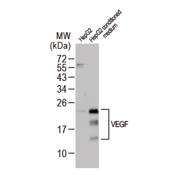 VEGF antibody (GTX132777)