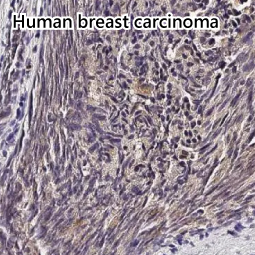 MMP9 antibody [HL3239]