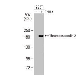 Thrombospondin 2 antibody [HL1194]