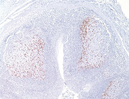 PD-1 antibody
(GTX20256)