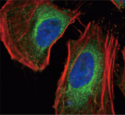 LDHA antibody