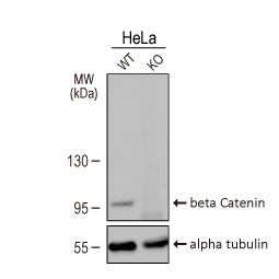 beta Catenin antibody [GT2169]