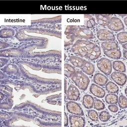 Desmoglein 2 antibody [HL2036]