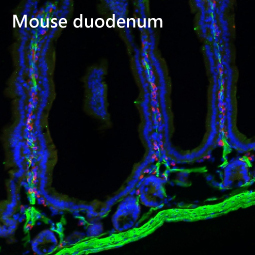 alpha Smooth Muscle Actin antibody [HL1419]