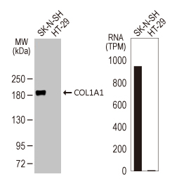 COL1A1 antibody [GT91]