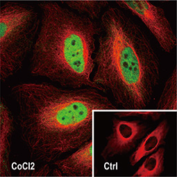 HIF1 alpha antibody