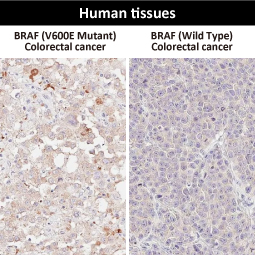 B-Raf (V600E Mutant) antibody [HL5673]