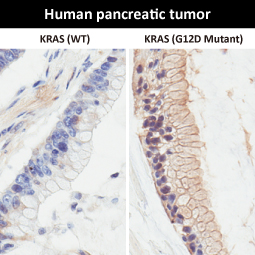 RAS (G12D Mutant) antibody [HL10]