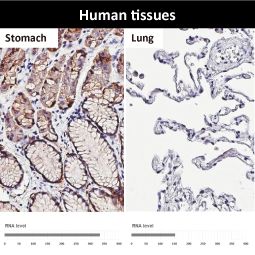 Claudin 18.2 antibody [HL5230]