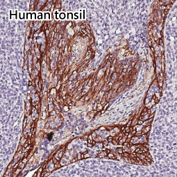 TACSTD2 antibody [HL5900]