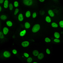 Rb antibody(GTX100545)