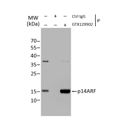 CDKN2A / p14ARF antibody (GTX129902)