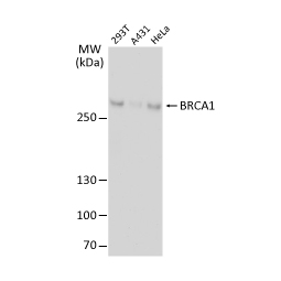 BRCA1 antibody(GTX70111)
