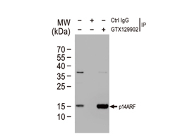 CDKN2A / p14ARF antibody (GTX129902)