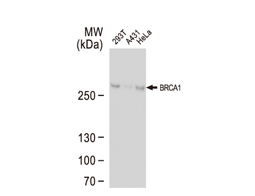 BRCA1 antibody
(GTX70111)