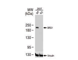 BRG1 antibody 
(GTX633391)