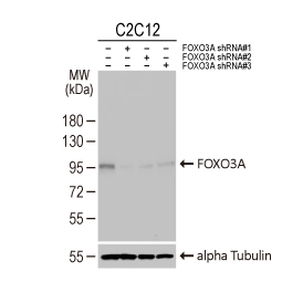 FOXO3A antibody [HL2190]