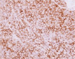 CD73 antibody (GTX113509)