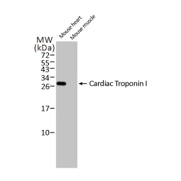 Cardiac Troponin I antibody [HL1489] (GTX636963)