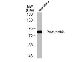 Prothrombin antibody (GTX101199)