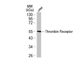 Thrombin Receptor antibody (GTX116035)