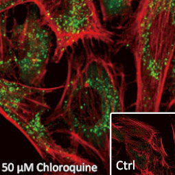SQSTM1 / P62 antibody [N3C1], Internal (GTX100685)