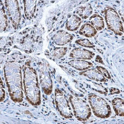 HMGB1 antibody(GTX101277)