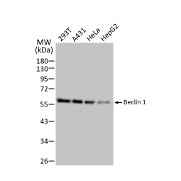 Beclin 1 antibody (GTX133555)