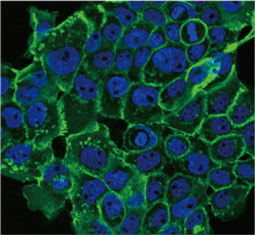 E-Cadherin antibody (GTX100443)