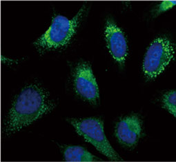 GRP94 antibody (GTX103232)